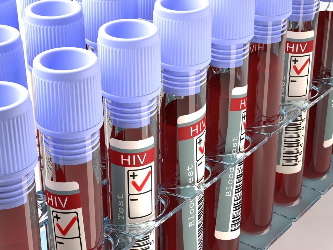 Hiv i Norge er ikke lenger en dødsdom som på 80-tallet, ei heller sett som en sykdom som bare rammer homofile og rusavhengige. Hiv i Norge er ikke lenger en dødsdom som på 80-tallet, ei heller sett som en sykdom som bare rammer homofile og rusavhengige.