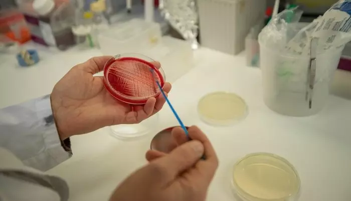 Forskerne fra UiT Norges arktiske universitet dyrket fram bakterien i petriskåler.