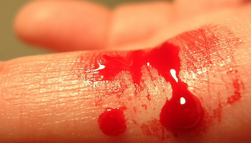 Hvorfor besvimer noen når de ser blod?