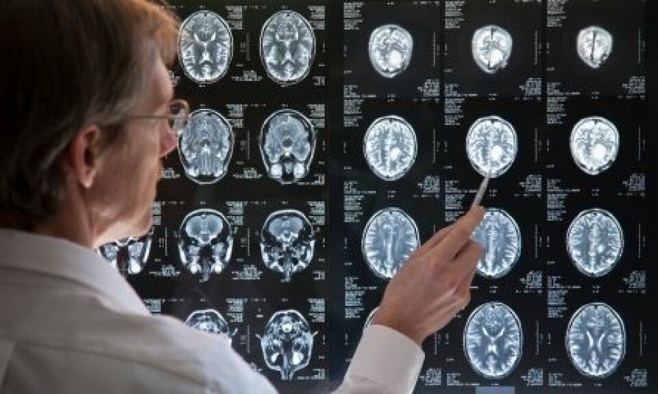 Hjerneskanning er en av flere metoder innen forskningen kan benyttes til å erverve ny kunnskap om hjernen og demenssykdom. (Foto: iStockphoto)
