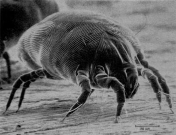 Hva synes du om å ha en gjeng slike kravlende rundt i øregangene dine? Det er ingen umulighet. (Foto: US Food and Drug Administration) Hva synes du om å ha en gjeng slike kravlende rundt i øregangene dine? Det er ingen umulighet. (Foto: US Food and Drug Administration)