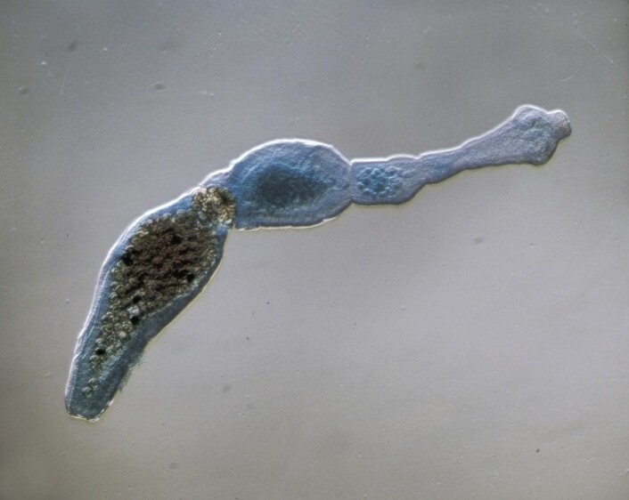 (Foto: Scanpix/Science Photo Library) (Foto: Scanpix/Science Photo Library)
