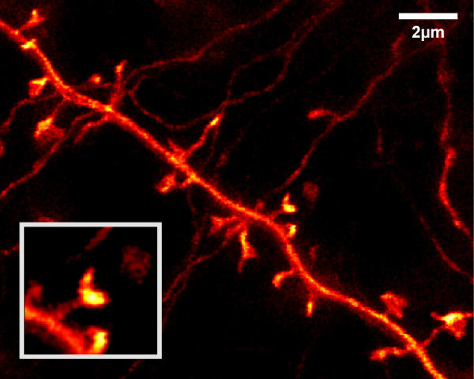 Del av dendritt fra nervecelle i levende musehjerne. Utsnittet nederst til venstre viser forstørrelse av en forgreningen til dendritten, hentet fra midten av det større bildet. Den viser en tynn hals og en fortykkelse i enden. (Foto: MPI for Biophysical Chemistry, Göttingen)