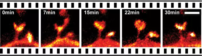 Bevegelsene i en del av dendritt fra nervecelle i levende musehjerne i løpet av en halv time. (Foto: MPI for Biophysical Chemistry, Göttingen)