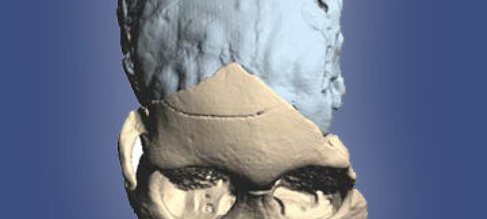 Taung-barnet (Australopithecus africanus), funnet i Sør-Afrika i 1924. Her er skallen rekonstruert som 3D-modell etter CT-scanning. (Bilde: M. Ponce de León and Ch. Zollikofer, University of Zurich)