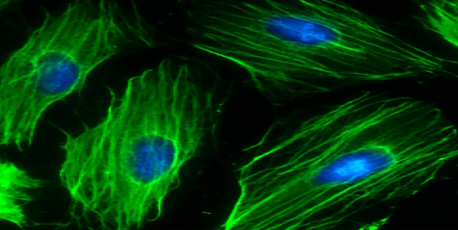 The picture shows heart cells formed by stem cells. The cell nucleus appears blue and stem cells are green. NTNU researchers have identified a protein that heart-diseased rats are deficit in, but which increases when the rats have been on an exercise regimen.