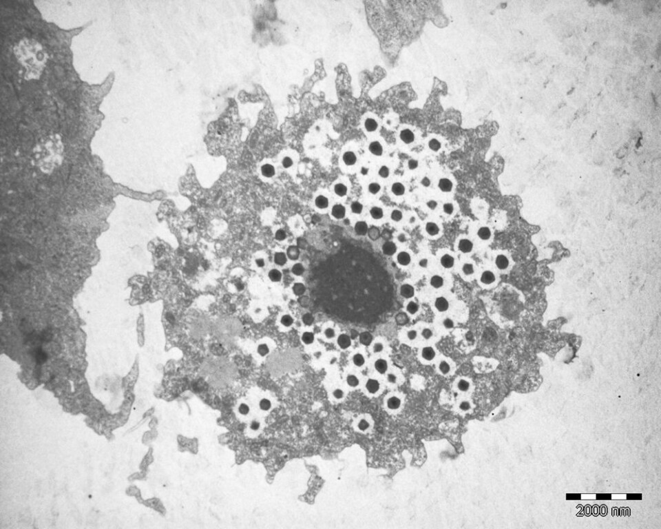 Kjempeviruset mimivirus infiserer en amøbe. Virusene - de små svarte sekskantede flekkene - er like store som enkelte bakterier. (Foto: Professor Didier Raoult, Rickettsia Laboratory, Frankrike)