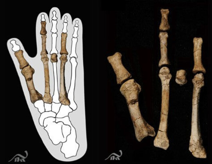 Dei nye fossile beinrestane tyder på ein mennesketype med fot som ein ape. Biletet til venstre viser beinrestane montert inn i omrisset av ein moderne gorillafot. (Foto: Yohannes Haile-Selassie, The Cleveland Museum of Natural History/ Montasje, NRK) Dei nye fossile beinrestane tyder på ein mennesketype med fot som ein ape. Biletet til venstre viser beinrestane montert inn i omrisset av ein moderne gorillafot. (Foto: Yohannes Haile-Selassie, The Cleveland Museum of Natural History/ Montasje, NRK)