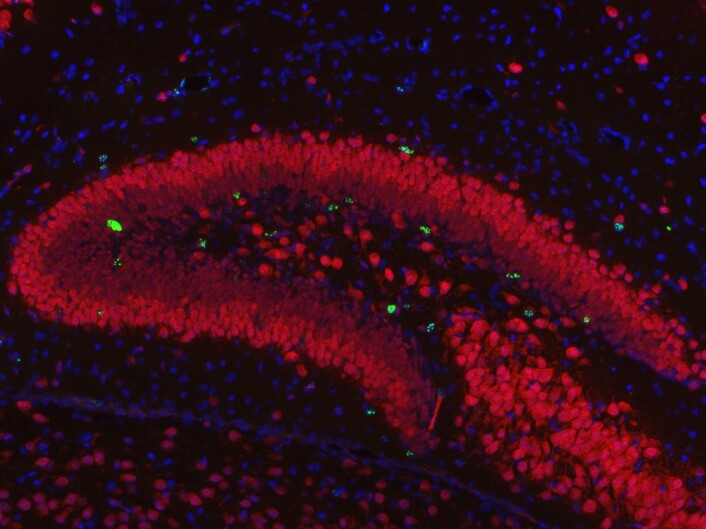 Slik ser det ut når cellene i hjernen din fornyer seg, nærmere bestemt i hippocampus. Denne celledelingen er viktig for at vi skal kunne huske og lære nye ting. De grønne prikkene viser selve celledelingen, og de røde er nerveceller. (Foto: Yngve Sejersted, OUS) Slik ser det ut når cellene i hjernen din fornyer seg, nærmere bestemt i hippocampus. Denne celledelingen er viktig for at vi skal kunne huske og lære nye ting. De grønne prikkene viser selve celledelingen, og de røde er nerveceller. (Foto: Yngve Sejersted, OUS)