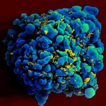 En HIV-infisert T-celle. Viruset integrerer DNA-et sitt i cellen og blir derfor reprodusert ved hver celledeling. (foto: National Institute of Allergy and Infectious Diseases)