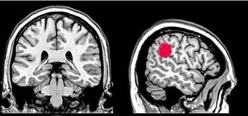 Ved funksjonell hjerneskanning i en fMRI-maskin kan forskere se hvilke funksjoner, strukturer og forbindelser som er aktiverti sving i hjernen når man hører stemmer som både kommer innenfra og utenfra. Det røde feltet viser hvor hjernen blir aktivert når man hører stemmer i hodet eller utenfra. (Foto: (Illustrasjon: Bergen fMRI-group)) Ved funksjonell hjerneskanning i en fMRI-maskin kan forskere se hvilke funksjoner, strukturer og forbindelser som er aktiverti sving i hjernen når man hører stemmer som både kommer innenfra og utenfra. Det røde feltet viser hvor hjernen blir aktivert når man hører stemmer i hodet eller utenfra. (Foto: (Illustrasjon: Bergen fMRI-group))