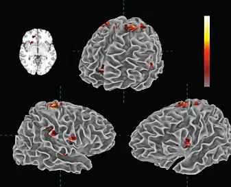 "Illustrasjonen viser de ulike områdene i hjernen som aktiveres ved musikklytting.