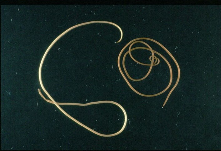 Taglormen Paragordius tricuspidatus. (Foto: Wikimedia Commons) Taglormen Paragordius tricuspidatus. (Foto: Wikimedia Commons)