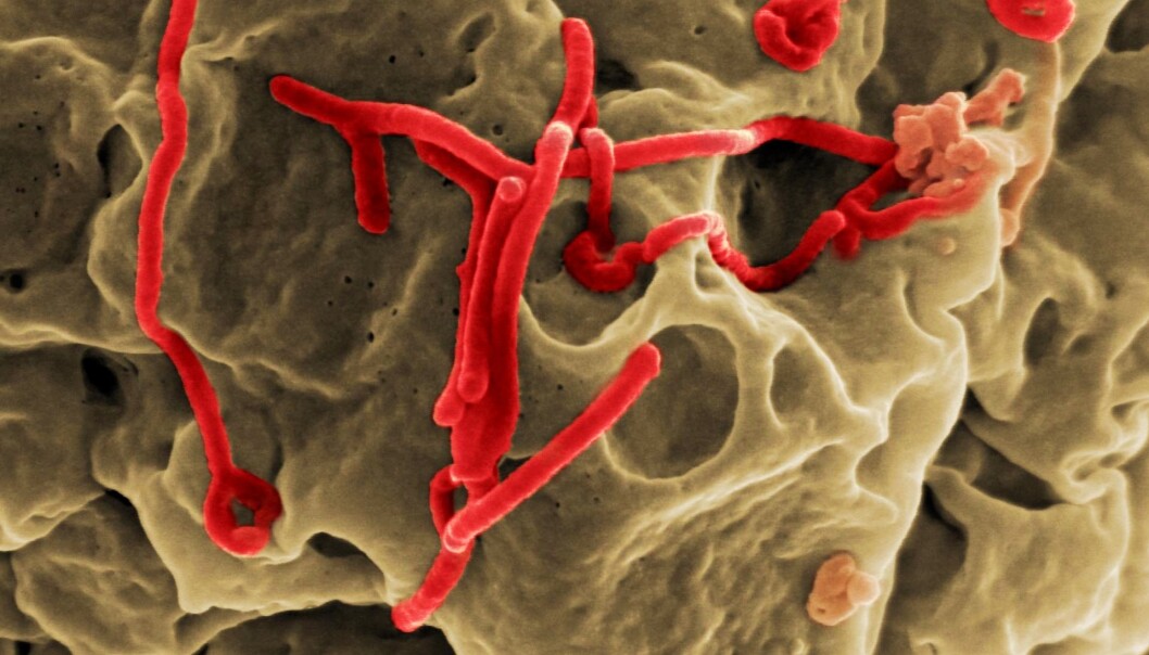Her har forskere brukt et skanningelektronmikroskop for å ta bilde av ebola-virus (rødt). De er oppå en celle i brunt. Elektronmikroskopbilder er i svarthvitt, bildet er kunstig farget. Her har forskere brukt et skanningelektronmikroskop for å ta bilde av ebola-virus (rødt). De er oppå en celle i brunt. Elektronmikroskopbilder er i svarthvitt, bildet er kunstig farget.
