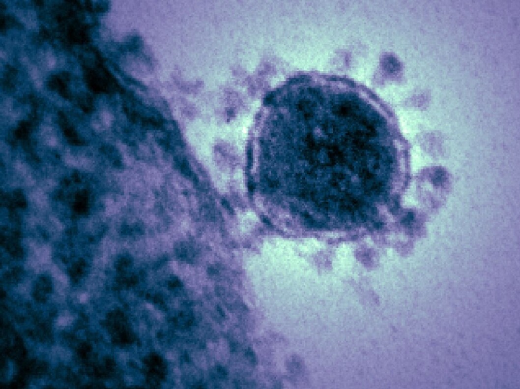 Dette bildet er av MERS-viruset som er beslektet med SARS-CoV-2. Her kan man se proteinpiggene, men ikke skarpt. Dette bildet er av MERS-viruset som er beslektet med SARS-CoV-2. Her kan man se proteinpiggene, men ikke skarpt.