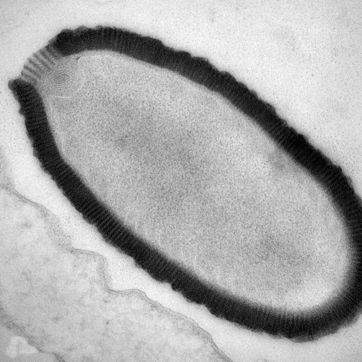 Elektronmikroskopbilde av det 30 000 år gamle kjempeviruset Pithovirus i en smittet Acanthamoeba-celle. (Foto: (Bilde: Julia Bartoli og Chantal Abergel, IGS and CNRS-AMU)) Elektronmikroskopbilde av det 30 000 år gamle kjempeviruset Pithovirus i en smittet Acanthamoeba-celle. (Foto: (Bilde: Julia Bartoli og Chantal Abergel, IGS and CNRS-AMU))