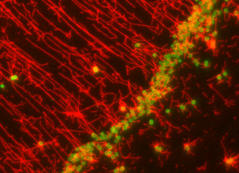 Her ser vi gonokokkbakterier som er farget med fluorescerende grønnfarge og det vanligste glykoproteinet i rødt. (Foto: Hanne Winther Larsen)