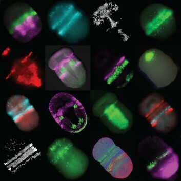 Selvlysende markører på hvert bilde viser de forskjellige genene som er skrudd på og lager proteiner i et eikenøttmarkembryo. Flere farger på ett bilde viser flere forskjellige geners aktivitet i det samme embryoet. (Foto: Ariel Pani)