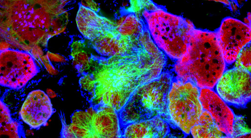 Kreftceller kan gå i dvale og unngå cellegift. Nå vet forskere mer om hvordan de skal vekke og drepe dem.