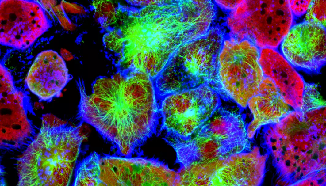 Forskere har avdekket en måte kreftceller beskytter seg mot cellegift.