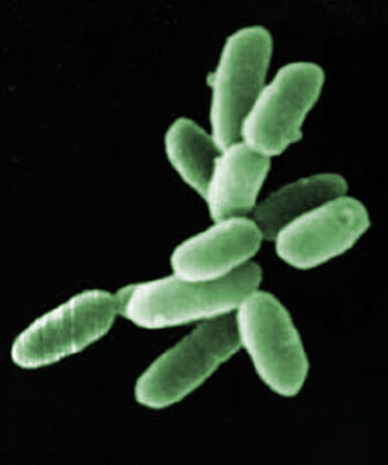 Halobacteria, eksempel på arkebakterie. Hver celle er omlag 5 tusendels millimeter lang. (Foto: (Bilde: NASA, farget av forskning.no)) Halobacteria, eksempel på arkebakterie. Hver celle er omlag 5 tusendels millimeter lang. (Foto: (Bilde: NASA, farget av forskning.no))