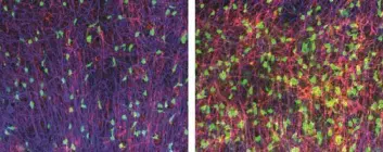 Bildet til venstre viser at hjerneskiver fra mus som ble dyrket i fysiologiske konsentrasjoner av sukker hadde unormalt lite myelin (rød-rosa farge). Bildet til høyre viser at tilførsel av melkesyre økte mengden myelin opp til normalt nivå. (Foto: Johanne E. Rinholm)