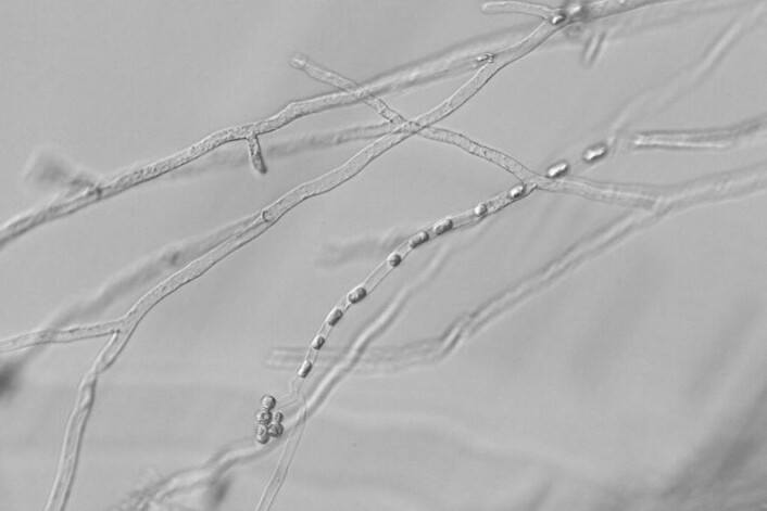 Hyfer med sporer (= sporangium) av eggsoresoppen Aphanomyces astaci. (Foto: David Strand) Hyfer med sporer (= sporangium) av eggsoresoppen Aphanomyces astaci. (Foto: David Strand)
