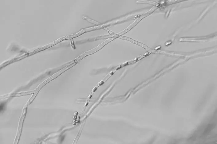 Hyfer med sporer (= sporangium) av eggsoresoppen Aphanomyces astaci. (Foto: David Strand)