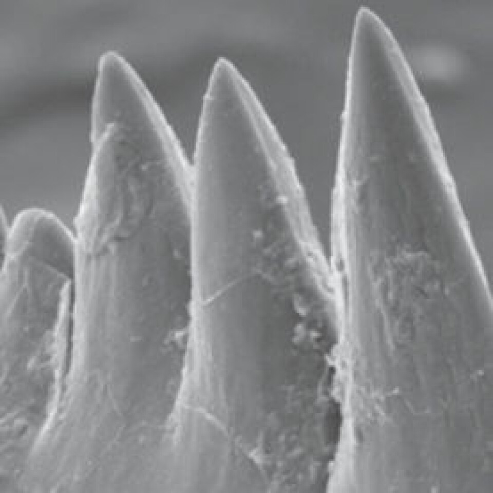 Fossile conodonttenner, sett gjennom ett elektronmikroskop-bilde. Tennene er bare 0,2 millimeter tvers over midten. (Foto: David Jones)