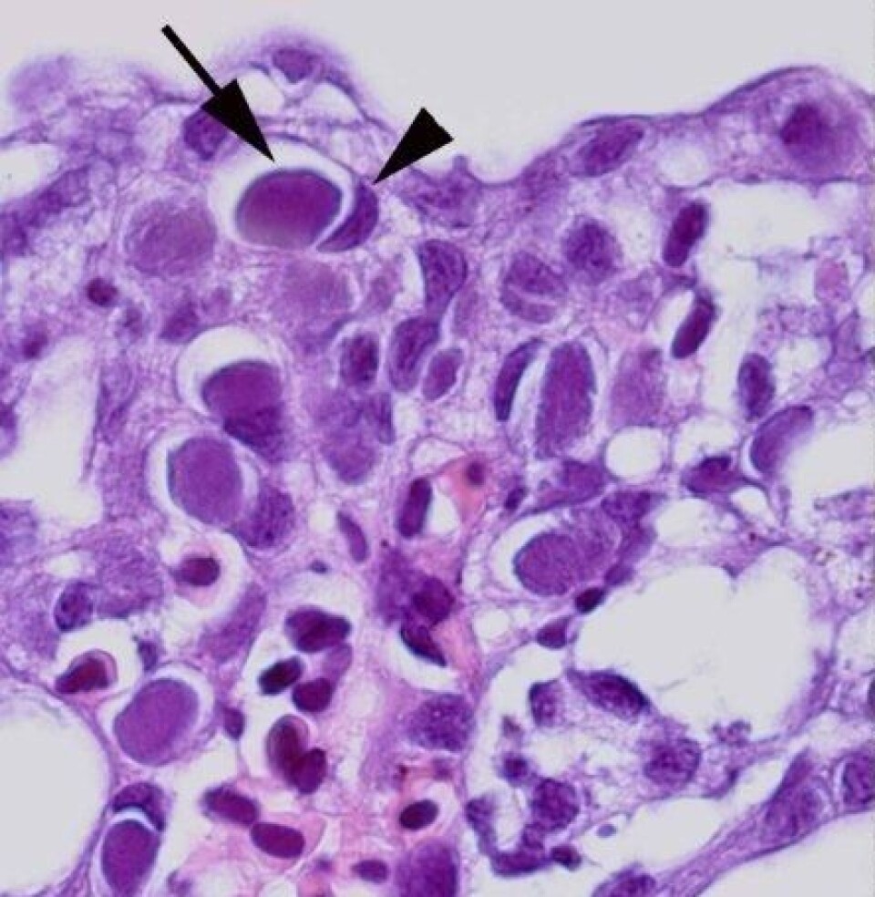 Mikroskopbilde av epiteliocystene (pil) i affiserte gjeller. Vertens egen cellekjerne er skjøvet til siden (pilhode). (Foto: Agnar Kvellestad)