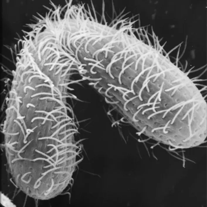 To Tetrahymena under paring. De encellede dyra har sju ulike kjønn og dermed stort utvalg på kjønnsmarkedet. (Foto: The ASSET (Advancing Secondary Science Education wiht Tetrahymena) Program at Cornell University)