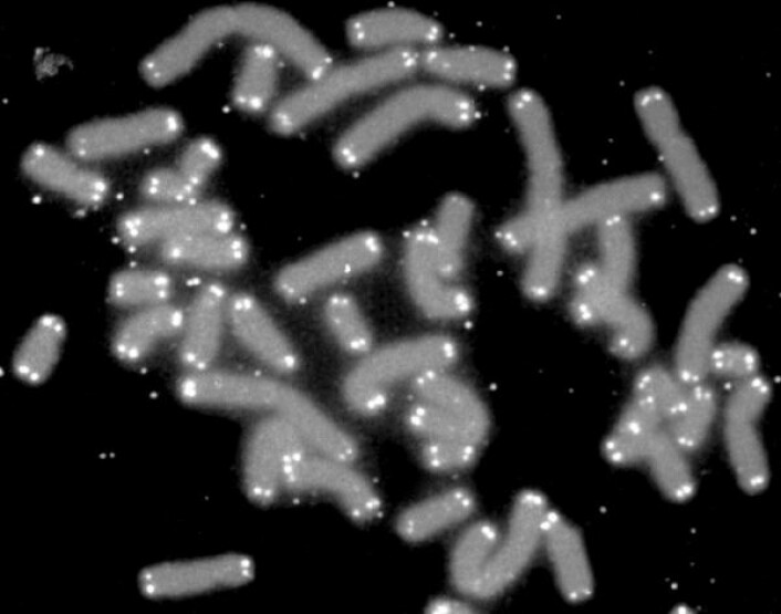 Menneskets kromosomer, med beskyttende telomerer (hvite) på tuppene. (Foto: Wikimedia Commons)