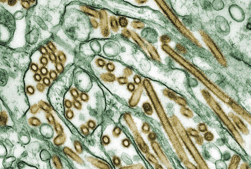 Den muterte formen av fugleinfluensa som presenteres i Nature-studien er helsemyndighetenes verste mareritt: Den smitter lett, mellom mennesker, og tar livet av omtrent halvparten de som blir syke. (Foto: CDC)
