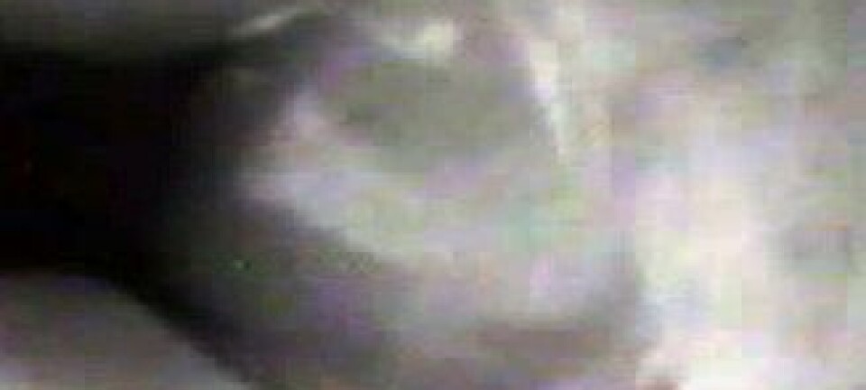 Cine-radiografi-bilder avbaby som ammer, fra studien. Elad, TAU, 2013