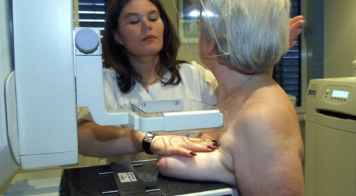 Oslo-kvinner møter sjeldnere opp til mammografi­screening