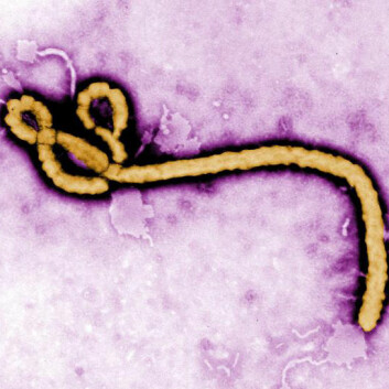 Fargelagt avbildning av Ebola-virus ved hjelp av et elektronmikroskop. (Foto: CDC)