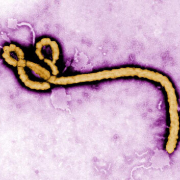 Fargelagt avbildning av Ebola-virus ved hjelp av et elektronmikroskop. (Foto: CDC) Fargelagt avbildning av Ebola-virus ved hjelp av et elektronmikroskop. (Foto: CDC)