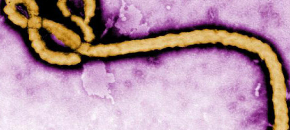 Fargelagt avbildning av Ebola-virus ved hjelp av et elektronmikroskop. (Foto: CDC)