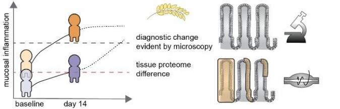 Proteomic analysis of coeliac patient intestinal tissue reveals certain people display low level inflammation that gives them a 'head start' when exposed to gluten (see chart to left of image). After 14 days their mucosal inflammation is therefore more severe (orange figure) than those without baseline inflammation (purple figure). The low level inflammation revealed by proteomics is not detected by the standard diagnostic approach of visualizing biopsies by microscopy. Proteomic analysis of coeliac patient intestinal tissue reveals certain people display low level inflammation that gives them a 'head start' when exposed to gluten (see chart to left of image). After 14 days their mucosal inflammation is therefore more severe (orange figure) than those without baseline inflammation (purple figure). The low level inflammation revealed by proteomics is not detected by the standard diagnostic approach of visualizing biopsies by microscopy.