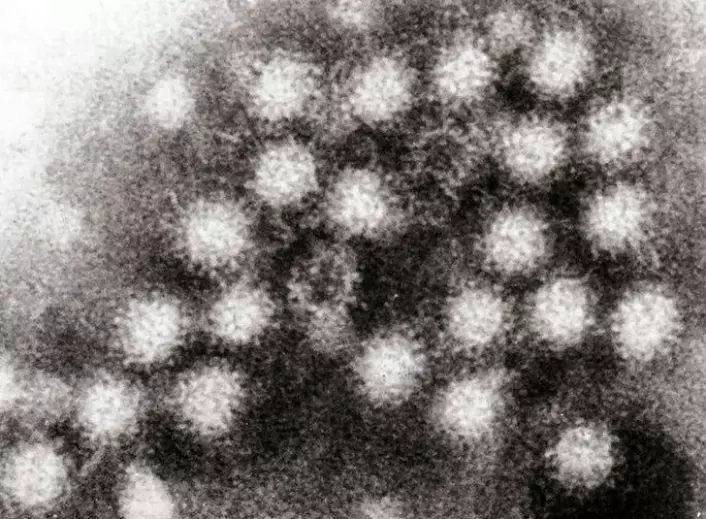 Portrett av fienden: noroviruset. (Foto: GrahamColm/Wikimedia Commons)