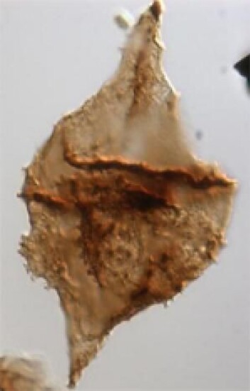Mikroskopbilde av et fossilt rødt plankton fra en av borekernerne. Det røde planktonet hadde bruk for oksygen og var avhengige av å kunne leve på havbunnen. (Foto: Bas van de Schootbrugge) Mikroskopbilde av et fossilt rødt plankton fra en av borekernerne. Det røde planktonet hadde bruk for oksygen og var avhengige av å kunne leve på havbunnen. (Foto: Bas van de Schootbrugge)