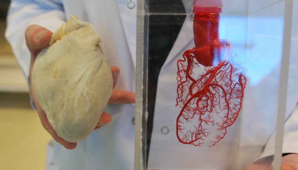 Hjertet i silikon til venstre, hjertet av herdeplast til høyre. Begge vender fremover, slik de satt da de befant seg inne i noens brystkasse. (Foto: Hanne Jakobsen)
