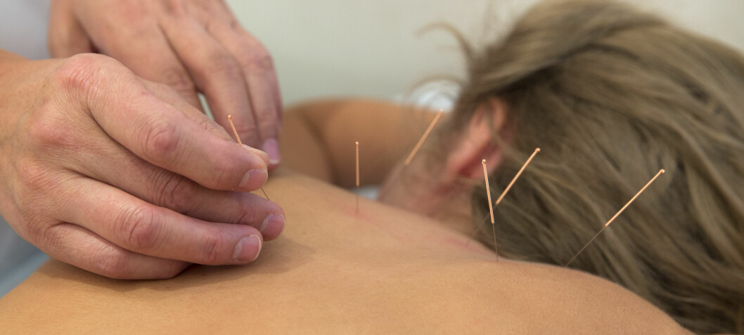 Akupunktur kan være et alternativ til antibiotika mot urinveisinfeksjoner