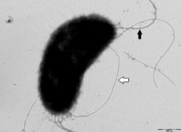Elektronmikroskopisk bilde av Vibrio salmonicida. (Foto: Hanne C. Winther-Larsen) Elektronmikroskopisk bilde av Vibrio salmonicida. (Foto: Hanne C. Winther-Larsen)