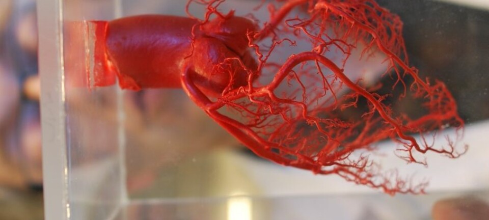 Hjertets blodårer er foreviget i herdeplast, og utstilt i anatomisk samling på St. Olavs Hospital i Trondheim. Der kan Ivar Skjåk Nordrum bruke dem til å vise en annen versjon av vår felles anatomi. Hanne Jakobsen