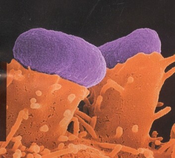 "Her har E. coli (lilla) har festet seg til tarmceller. Foto: Ilan Rosenshine, The Hebrew University i Jerusalem." "Her har E. coli (lilla) har festet seg til tarmceller. Foto: Ilan Rosenshine, The Hebrew University i Jerusalem."
