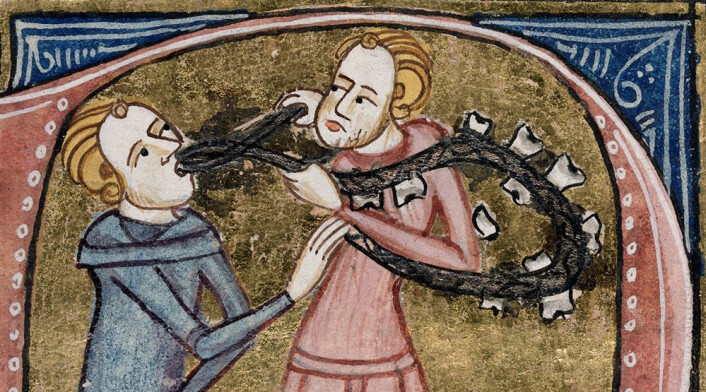 Tannuttrekning i middelalderen. (Foto: (Tegning: James le Palmer, London 1360-1375)) Tannuttrekning i middelalderen. (Foto: (Tegning: James le Palmer, London 1360-1375))