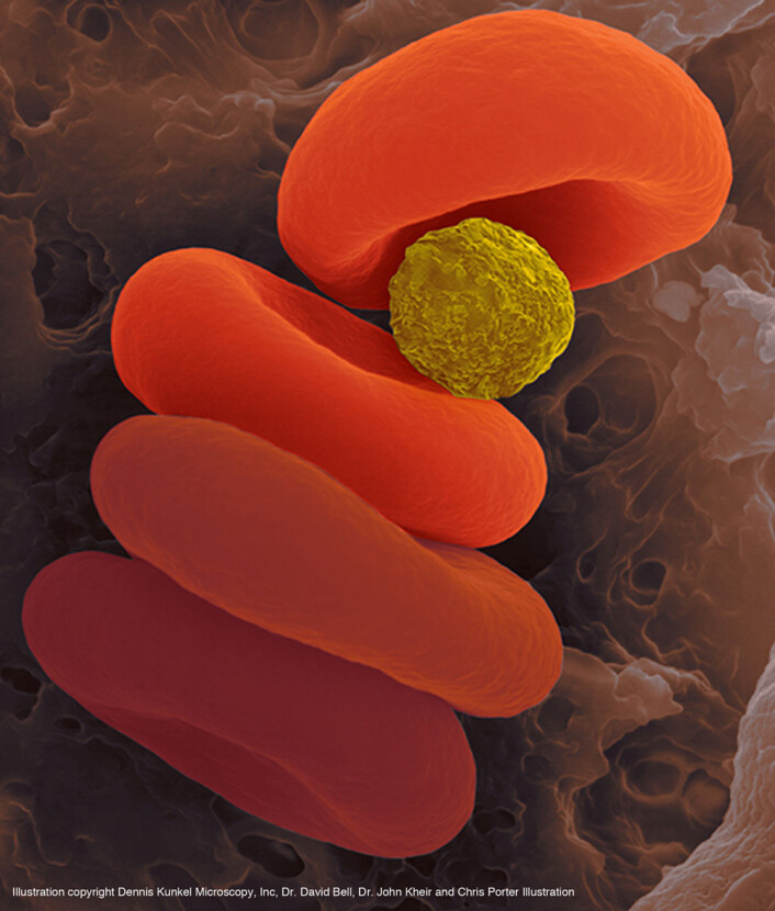 Når mikropartiklene møter blodceller uten oksygen, overføres oksygenet fra partiklene umiddelbart. (Foto: D. Kunkel/Dennis Kunkel Microscopy, Inc., D. Bell/Harvard University, J. Kheir/Children’s Hospital Boston, C. Porter/Chris Porter Illustration) Når mikropartiklene møter blodceller uten oksygen, overføres oksygenet fra partiklene umiddelbart. (Foto: D. Kunkel/Dennis Kunkel Microscopy, Inc., D. Bell/Harvard University, J. Kheir/Children’s Hospital Boston, C. Porter/Chris Porter Illustration)