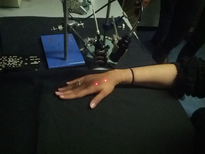 Laserstrålene kjentes som to stikkende punkter. (Foto: University College London) Laserstrålene kjentes som to stikkende punkter. (Foto: University College London)