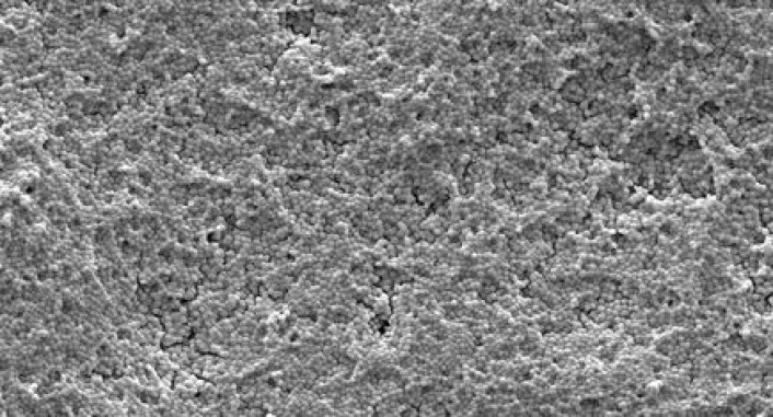 "Streptococcus intermedius som har dannet biofilm." "Streptococcus intermedius som har dannet biofilm."